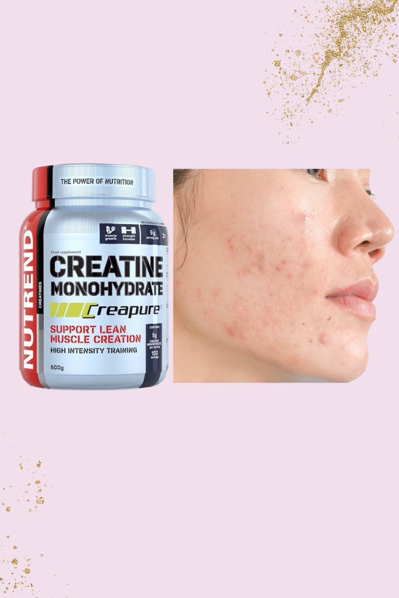 Does Creatine Cause Acne? | My Clear Beauty